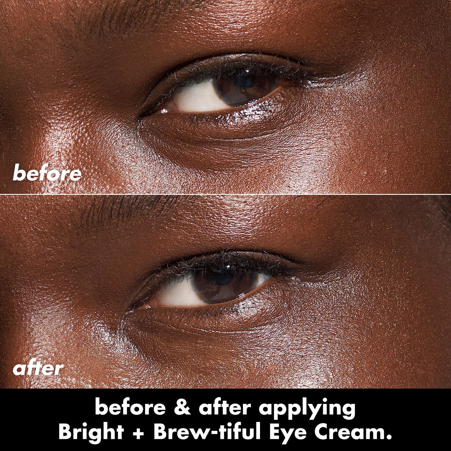 bright-brew-tiful-eye-cream-o5 0226_BBEC_Eye_BA_Diptych_607e3ec2-f0e1-4365-9b28-17574d841250.jpg