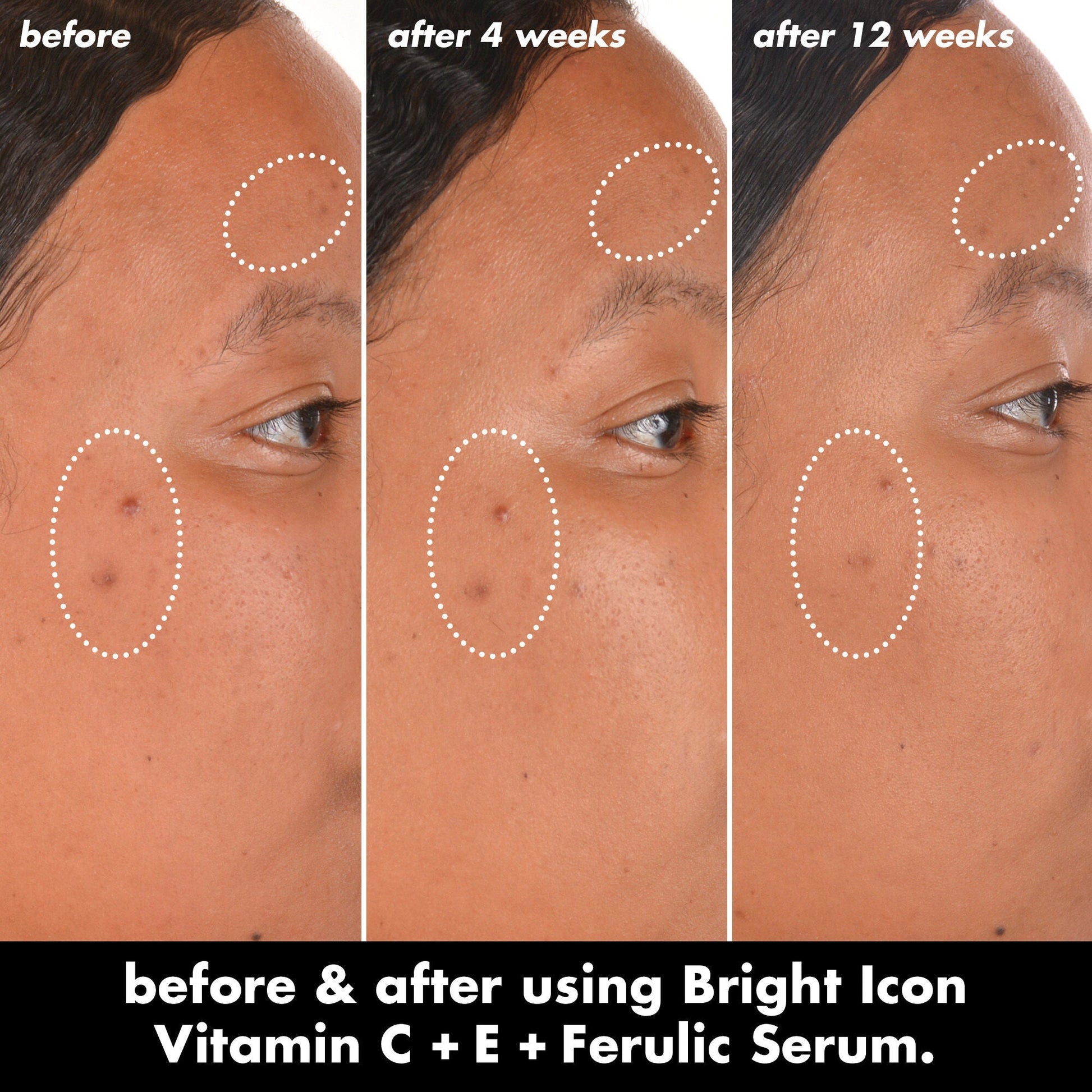 bright-icon-vitamin-c-e-ferulic-serum-c9 0226_EDU_BrightIconVitC_BA_Chanel_TRIPTYCH_c58f2fc8-209d-414f-9ba3-666a07a94887.jpg