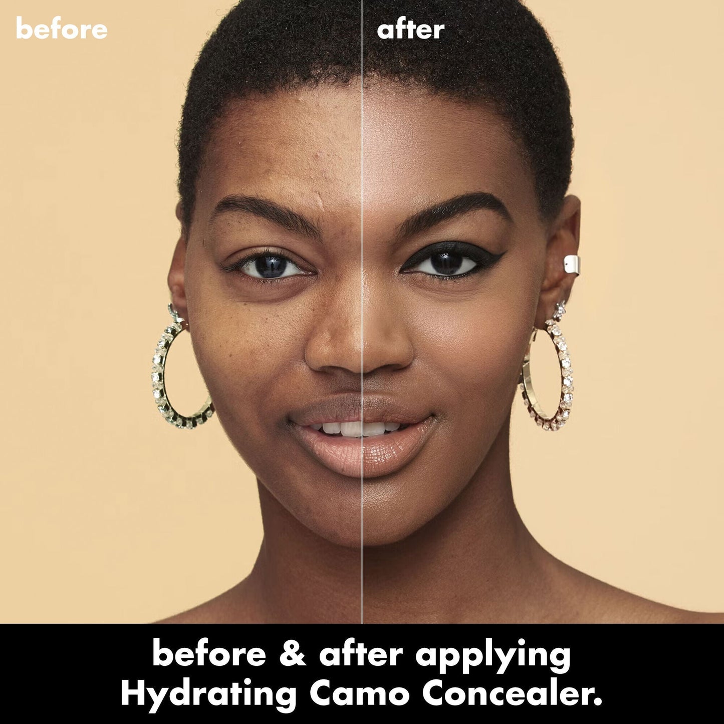 hydrating-camo-concealer-x9 0226_EDU_HydratingCamoConcelaer_BA_AshleyKaresh_20_1_d8499bbf-0e91-4173-b5e2-75127caf83a3.jpg