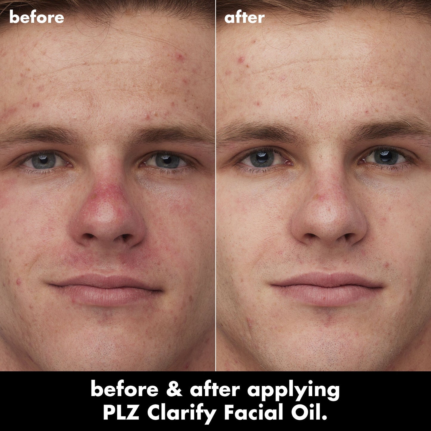 plz-clarify-facial-oil-c1 0326_EDU_PlzClarify_BA_Caleb.jpg