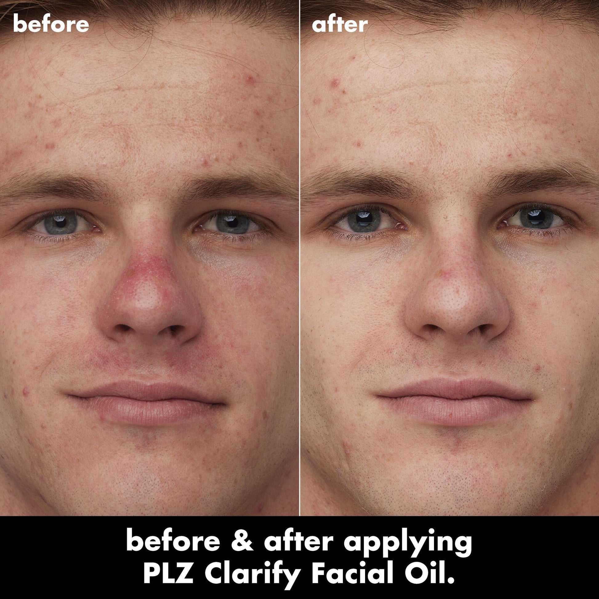 plz-clarify-facial-oil-c1 0326_EDU_PlzClarify_BA_Caleb.jpg