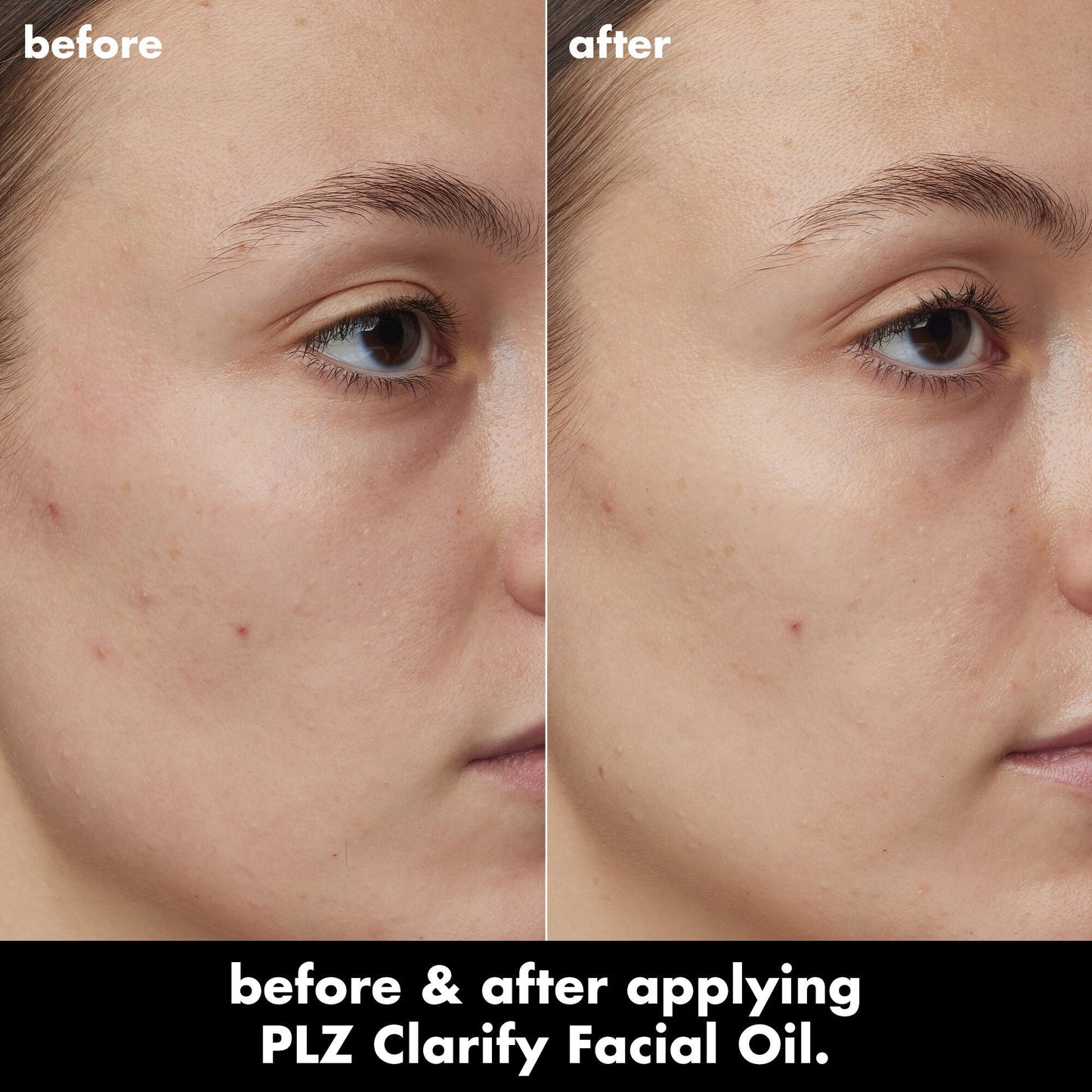 plz-clarify-facial-oil-c1 0326_EDU_PlzClarify_BA_Kelly.jpg