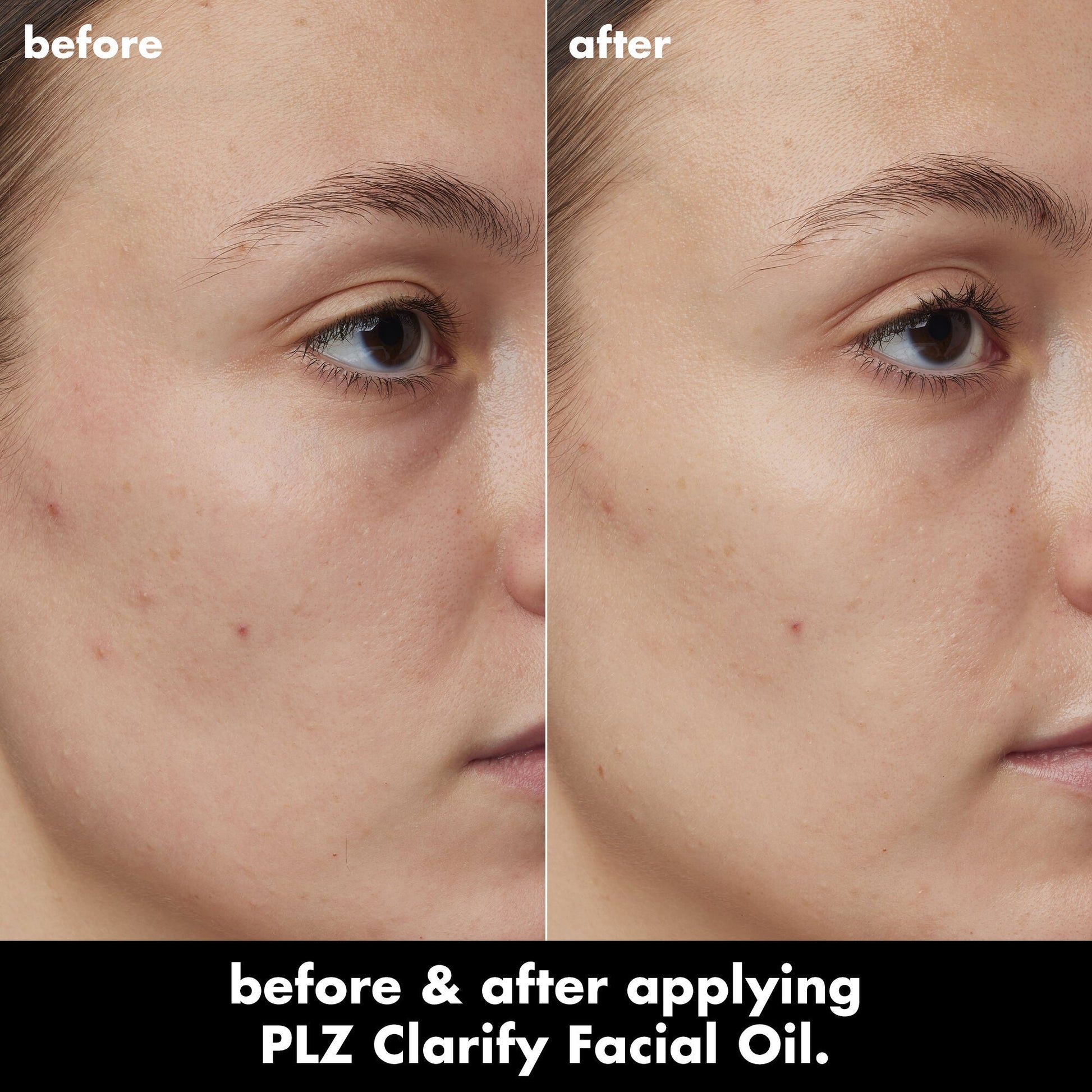 plz-clarify-facial-oil-c1 0326_EDU_PlzClarify_BA_Kelly.jpg