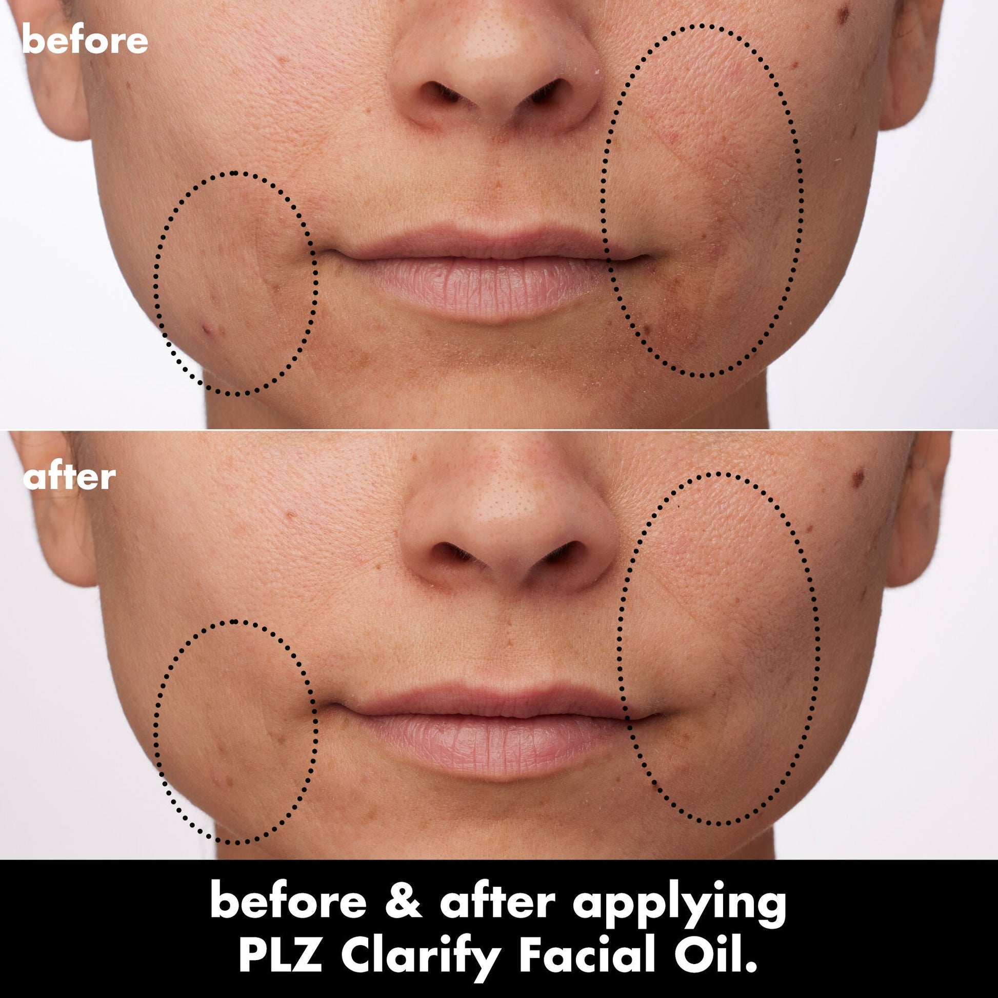 plz-clarify-facial-oil-c1 0326_EDU_PlzClarify_BA_Paula.jpg