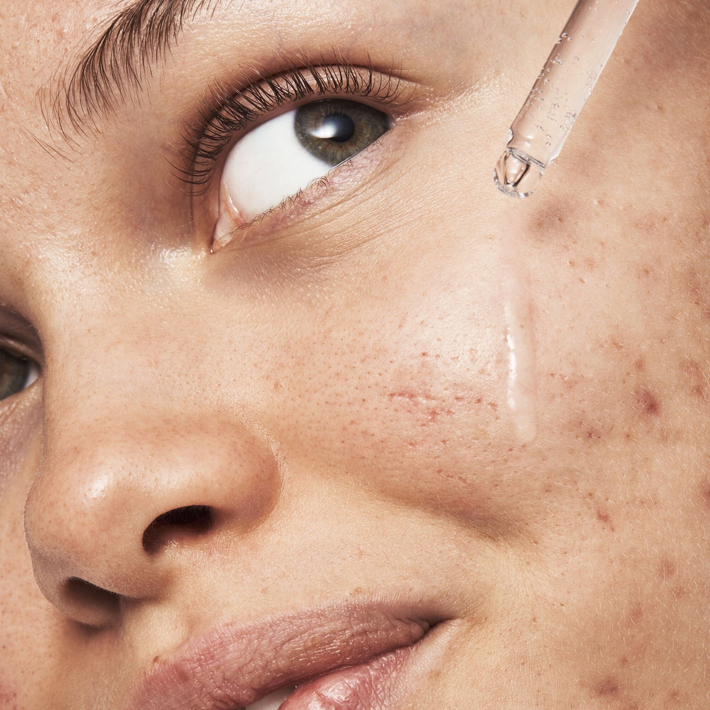 blemish-breakthrough-triple-acid-resurfacing-serum-m3 121321_Marley-Acne-Regimen_0254_FINAL_IGF.jpg