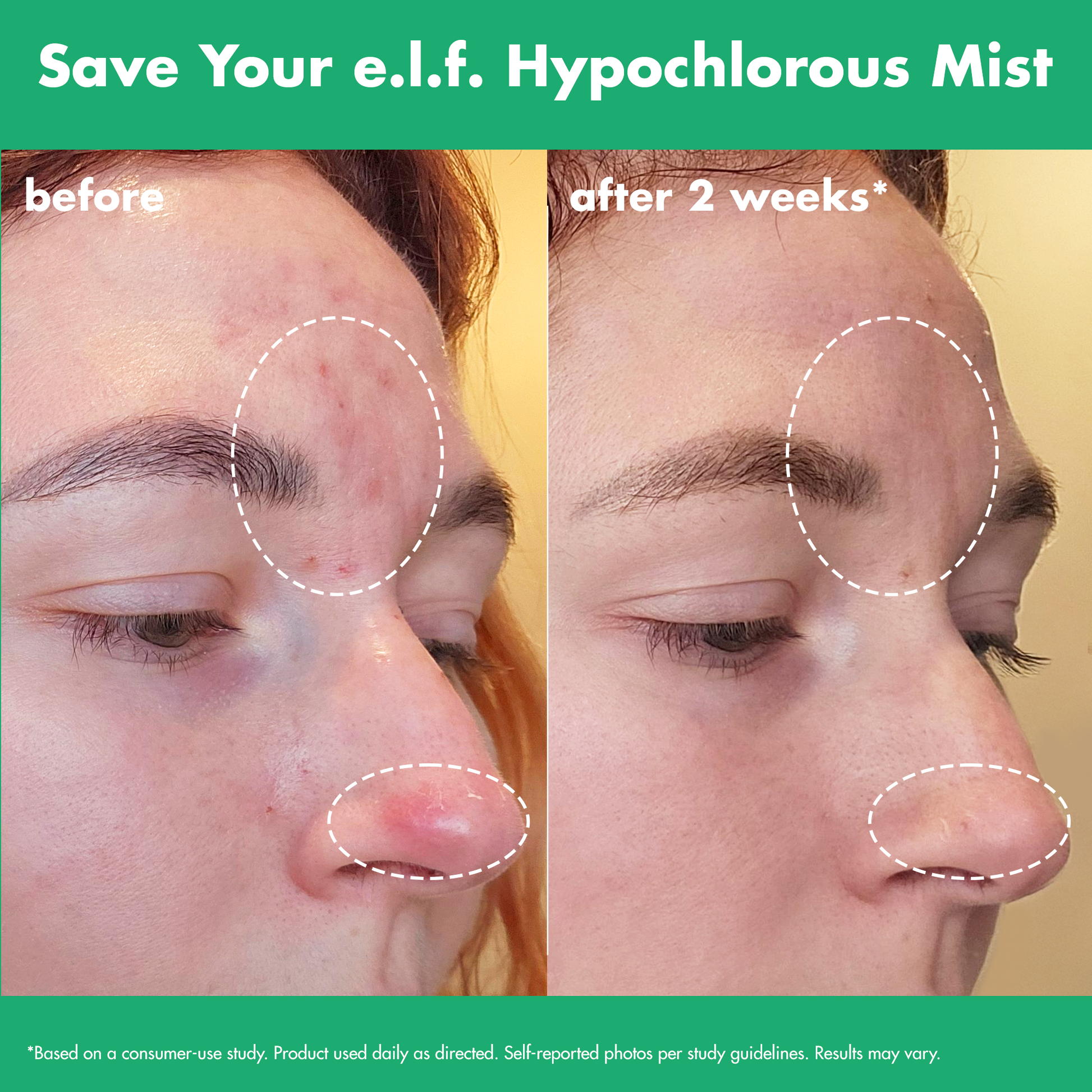 save-your-e-l-f-hypochlorous-mist-f3 FA26_EDUCATION_SAVEYOURELF_USAGE_BA1_WITHOUT_CLAIMS.png