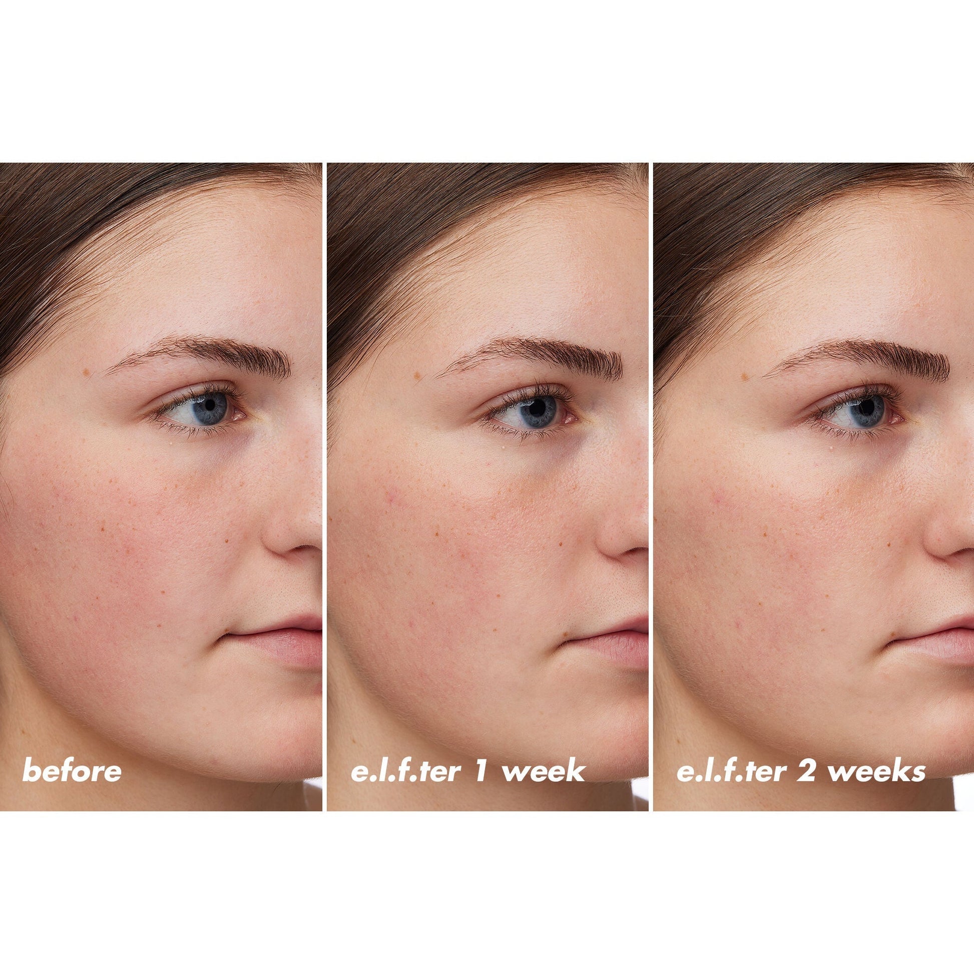 holy-hydration-barrier-goals-cream-regular-u2 XX26_EDUCATION_HH-BarrierGoals_B_A_Zoe_TRYPTICH_74c905bd-67bd-4b91-b633-2b01a8905cb8.jpg